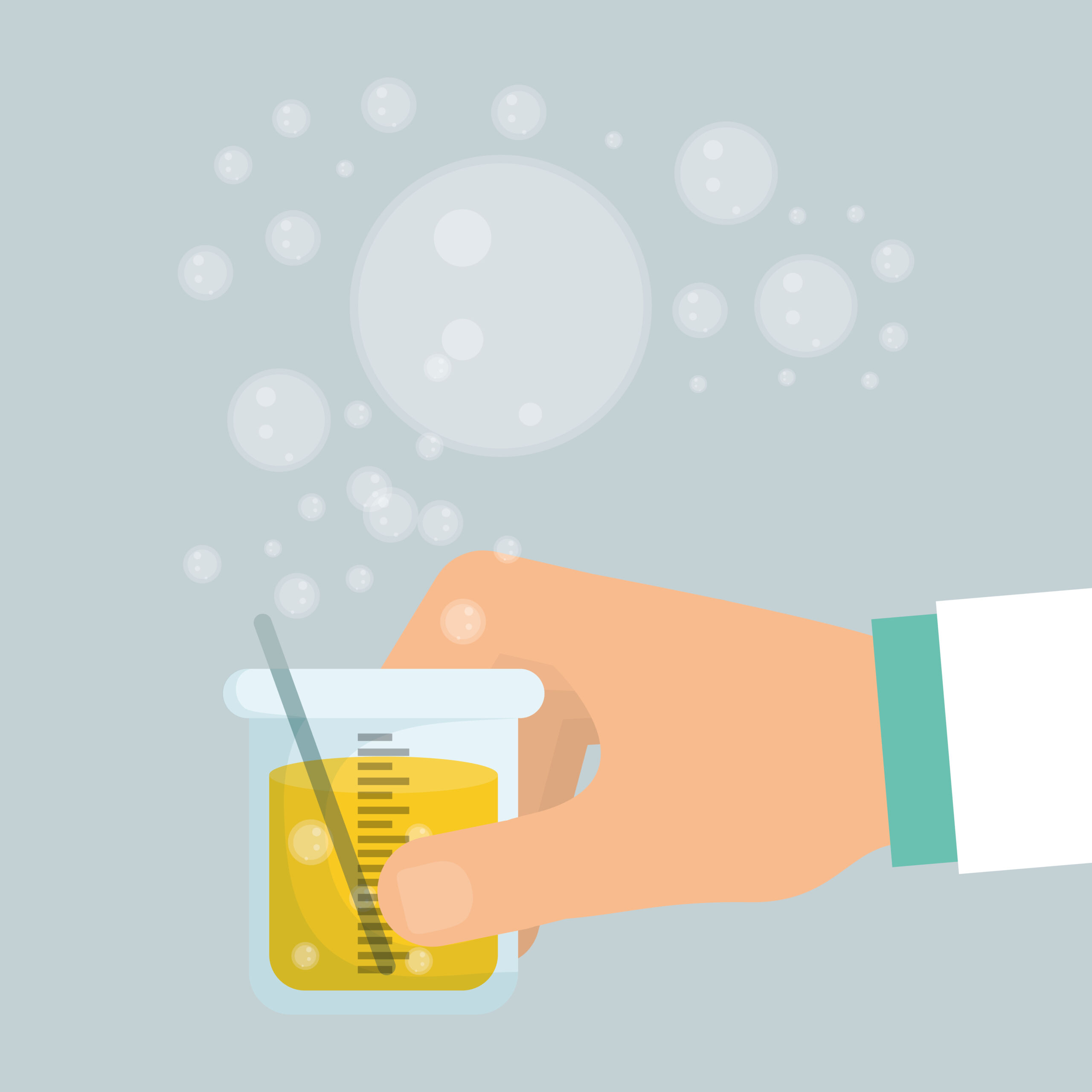Kryptopyrrole Testing: scientist holds a flask with urine sample